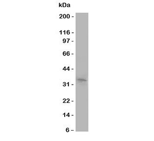 <p>Western blot testing of Aquaporin 10 / AQP10 antibody (<a href="../tds/aquaporin-10-antibody-r31207" target="_blank" rel="noopener">cat # R31207</a>) and human COLO320 cell lysate.</p>