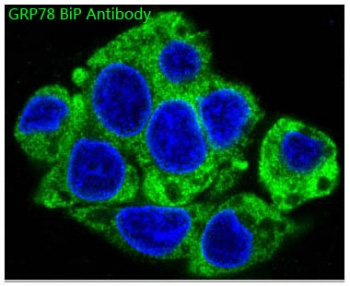 <p>Immunofluorescent staining of FFPE human HepG2 cells with GPR78 / BiP antibody (green,&nbsp;<a href="../tds/bip-antibody-grp78-hspa5-boo-8-rq5350" target="_blank" rel="noopener">cat # RQ5350</a>) and DAPI nuclear stain (blue). HIER: steam section in pH6 citrate buffer for 20 min.</p>