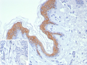 <p>IHC staining of FFPE human skin tissue with Cytokeratin 1 antibody (<a href="../tds/cytokeratin-1-antibody-ck1-krt1-krt18342r-v4284" target="_blank" rel="noopener">clone KRT1/8342R, cat # V4284</a>). Inset: PBS used in place of primary Ab (secondary Ab negative control).</p>