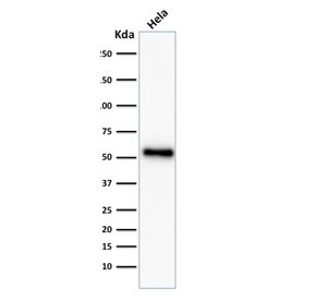 <p>Western blot testing of human HeLa cell lysate with recombinant <a href="../tds/recombinant-p53-antibody-rabbit-monoclonal-tp532092r-v3646" target="_blank" rel="noopener">p53 antibody</a> (clone TP53/2092R).</p>