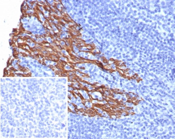 <p>IHC staining of FFPE human tonsil tissue with recombinant Cytokeratin 5 antibody (<a href="../tds/recombinant-krt5-antibody-cytokeratin-5-rkrt56969-v4279" target="_blank" rel="noopener">clone rKRT5/6969, cat # V4279</a>). Inset: PBS used in place of primary Ab (secondary Ab negative control).</p>