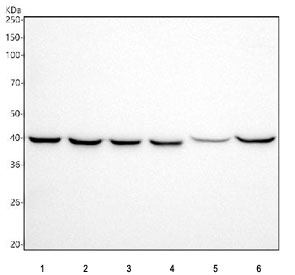 <p>Western blot testing of 1) human HepG2, 2) human Caco-2, 3) human PC-3, 4) human K562, 5) rat lung and 6) rat liver tissue lysate with <a href="../tds/acat1-antibody-acetyl-coa-acetyltransferase-rq8786" target="_blank" rel="noopener">ACAT1 antibody (Cat # RQ8786)</a>. Predicted molecular weight ~45 kDa.</p>