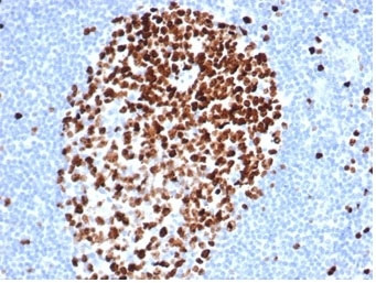 <p>IHC staining of FFPE human tonsil tissue with recombinant Ki67 antibody (clone MKI67/4947R, <a href="../tds/recombinant-ki67-antibody-mki674947r-v9348" target="_blank" rel="noopener">Cat # V9384</a>). HIER: boil tissue sections in pH 9 10mM Tris with 1mM EDTA for 20 min and allow to cool before testing.</p>