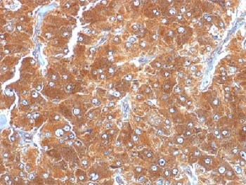 <p><strong data-start="0" data-end="36" data-is-only-node="">Perilipin 2 Antibody Adrenal Gland IHC.</strong> Immunohistochemistry analysis of FFPE human adrenal tissue using Perilipin 2 Antibody clone ADFP/1494 demonstrates strong HRP-DAB brown cytoplasmic staining throughout adrenal cortical cell populations. The staining pattern is consistent with the established localization of Adipophilin / ADRP / PLIN2, a lipid droplet-associated protein involved in intracellular lipid storage, fatty acid metabolism, and cellular lipid homeostasis. Required HIER: steam sections in pH6, 10mM citrate buffer for 10-20 min.</p>