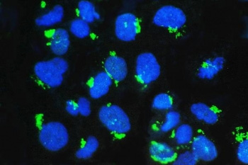 <p>Immunofluorescent staining of FFPE human U-2 OS cells with <a href="../tds/gm130-antibody-golga2-rq4570" target="_blank" rel="noopener">GM130 antibody</a> (green) and DAPI nuclear stain (blue).</p>