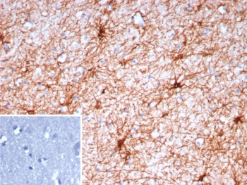 <p>IHC staining of FFPE human brain tissue with <a href="../tds/gfap-antibody-glial-fibrillary-acidic-protein-gfap9423-v5714" target="_blank" rel="noopener">Glial Fibrillary Acidic Protein antibody</a> (clone GFAP/9423). Inset: PBS used in place of primary Ab (secondary Ab negative control). HIER: boil tissue sections in pH 9 10mM Tris with 1mM EDTA for 20 min and allow to cool before testing.</p>
