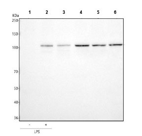 <p>Western blot testing of human 1) ThP-1 without LPS treatment, 2) ThP-1 with LPS treatment, 3) HaCaT, 4) PC-3, 5) Caco-2 and 6) HepG2 cell lysate with <a href="../tds/tlr2-antibody-r32649">TLR2 antibody</a>. Predicted molecular weight: 85-90 kDa.</p>
