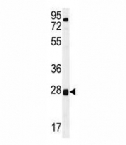 TOR2A antibody western blot analysis in human placenta tissue lysate.