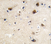 IHC analysis of FFPE human brain tissue stained with Calmodulin antibody