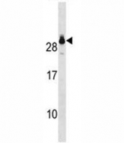 GSTT2 antibody western blot analysis in A549 lysate.