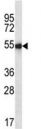 Ihh antibody western blot analysis in mouse liver tissue lysate