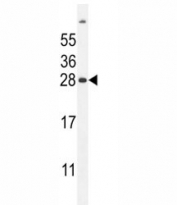 FAT10 Antibody Mouse Liver WB. Western blot analysis of FAT10 expression was performed using anti-FAT10 antibody in mouse liver tissue lysate. FAT10, also known as Ubiquitin D (UBD), is a ubiquitin-like modifier that targets proteins for proteasomal degradation and plays important roles in immune regulation, inflammatory signaling, and protein homeostasis. A specific immunoreactive band is detected at approximately 28 kDa, consistent with the observed migration of FAT10 under these experimental conditions. Differences between predicted and apparent molecular weight may reflect the biochemical properties of this ubiquitin-like protein or post-translational modification. These results support the utility of FAT10 Antibody for studies of proteasomal degradation, ubiquitin-like protein conjugation, immune responses, and inflammation.