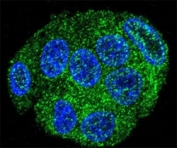 FAT10 Antibody Human HepG2 IF. Immunofluorescent staining of human HepG2 cells with FAT10 antibody demonstrated punctate cytoplasmic staining (green), consistent with the intracellular localization of FAT10 (Ubiquitin D, UBD), a ubiquitin-like modifier that targets proteins for proteasomal degradation and regulates immune and inflammatory signaling. FAT10 expression is induced by pro-inflammatory cytokines and participates in protein quality control, antigen processing, and cellular stress responses. The punctate cytoplasmic distribution is consistent with the localization of FAT10-associated protein conjugates within the cytoplasm. Alexa Fluor 488-conjugated goat anti-rabbit IgG was used for detection, and nuclei were counterstained with DAPI (blue). These results support the utility of FAT10 Antibody for studies of ubiquitin-like protein modification, proteasomal degradation, immune regulation, and cancer biology.
