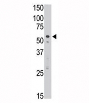 SIGLEC7 antibody used in western blot to detect Dsiglec/SIGLEC7 in Jurkat cell lysate