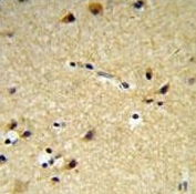 CYP26A1 antibody IHC analysis in formalin fixed and paraffin embedded brain tissue.