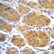 AARS2 antibody immunohistochemistry analysis in formalin fixed and paraffin embedded human stomach tissue.