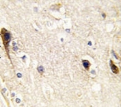 IHC analysis of FFPE human brain tissue stained with PIP5K1B antibody