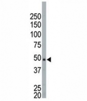 NEK2 antibody used in western blot to detect NEK2 in HeLa cell lysate