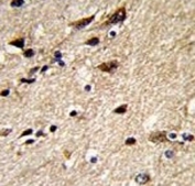 IHC analysis of FFPE human brain stained with b-Tubulin antibody