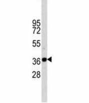 Western blot analysis of anti-GAPDH antibody and CEM lysate