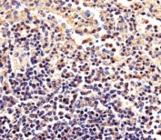 Immunohistochemical analysis of paraffin-embedded human spleen using beta-Actin antibody at 1:25 dilution.