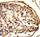 IHC analysis of FFPE human testis stained with beta-Tubulin antibody