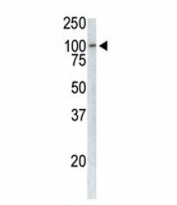 Western analysis of extracts from Jurkat cells using TPX2 antibody.
