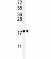 Western blot analysis of UBC9 antibody and Ramos lysate