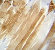 Nucleolin antibody immunohistochemistry analysis in formalin fixed and paraffin embedded human skeletal muscle.