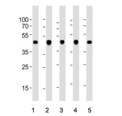 Western blot testing of 1) human A431, 2) rat C2C12, 3) rat C6, 4) human HeLa and 5) human MCF7 cell lysate with b-Actin antibody. Predicted molecular weight ~42 kDa.