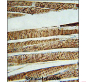 IHC staining of FFPE human skeletal muscle tissue with b-Actin antibody. HIER: steam section in pH6 citrate buffer for 20 min and allow to cool prior to staining.