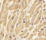 IHC staining of FFPE human heart tissue with b-Actin antibody. HIER: steam section in pH6 citrate buffer for 20 min and allow to cool prior to staining.