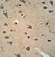 ALDH2 antibody immunohistochemistry analysis in formalin fixed and paraffin embedded human brain tissue.