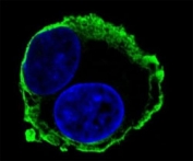 Confocal immunofluorescent analysis of MMP14 antibody with HepG2 cells followed by Alexa Fluor 488-conjugated goat anti-mouse lgG (green). DAPI was used as a nuclear counterstain (blue).