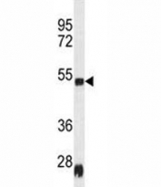 SERPINH1 Antibody Rat Heart WB. Western blot analysis was performed using SERPINH1 Antibody on rat heart tissue lysate. A distinct immunoreactive band is detected at approximately 47 kDa, consistent with the expected molecular weight of Heat Shock Protein 47 (SERPINH1). The observed band demonstrates specific detection of this collagen-specific molecular chaperone in cardiac tissue, where extracellular matrix maintenance and collagen homeostasis are essential for normal structural integrity. This SERPINH1 Antibody / Heat Shock Protein 47 Antibody is well suited for Western blot studies of collagen biosynthesis, endoplasmic reticulum function, tissue remodeling, and fibrosis research.