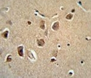 SERPINH1 Antibody Human Brain IHC. SERPINH1 Antibody was used for immunohistochemical staining of FFPE human brain tissue. Following antigen retrieval, the tissue was incubated with the primary antibody, followed by an HRP-conjugated secondary antibody and chromogenic detection. Distinct cytoplasmic staining is observed in neuronal cell bodies, consistent with the intracellular localization of Heat Shock Protein 47 (HSP47), a collagen-specific molecular chaperone residing within the endoplasmic reticulum. This SERPINH1 Antibody / Heat Shock Protein 47 Antibody is suitable for immunohistochemical studies of protein folding, extracellular matrix biology, collagen biosynthesis, and tissue remodeling.