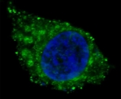 Fluorescent confocal image of HepG2 cells stained with ALDH1A1 antibody. ALDH1A1 immunoreactivity is localized to the cytoplasm.