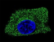 Confocal immunofluorescent analysis of LAMP2 antibody with HepG2 cells followed by Alexa Fluor 488-conjugated goat anti-mouse lgG (green). DAPI was used as a nuclear counterstain (blue).