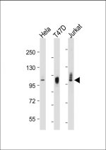 LAMP2 Antibody in HeLa, T47D and Jurkat Cell Lysates WB. Western blot testing of HeLa, T47D and Jurkat whole cell lysates with LAMP2 Antibody detects a prominent species at approximately 100-110 kDa, with particularly strong signal in T47D cells. Although the predicted unglycosylated molecular weight of LAMP2 is approximately 45 kDa, extensive glycosylation causes the mature lysosomal membrane protein to migrate substantially higher by SDS-PAGE. The observed high-molecular-weight CD107b signal is therefore consistent with the expected migration of mature LAMP2 protein.