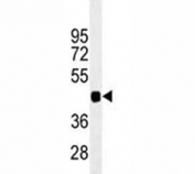 PAX6 antibody western blot analysis in 293 lysate. Predicted molecular weight ~48kDa.