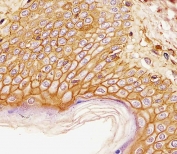 CD44 Antibody Skin Tissue IHC. Immunohistochemistry analysis of CD44 / CD44 antigen expression in FFPE human skin tissue using mouse monoclonal antibody clone Hermes-3. Membranous HRP-DAB brown staining is observed throughout stratified squamous epithelial layers, clearly outlining cell borders and demonstrating organized epithelial architecture consistent with CD44 expression. The staining pattern highlights uniform cell surface localization and supports its use for evaluating epithelial structure and CD44-associated cell adhesion in skin tissue. Heat induced epitope retrieval was performed by boiling tissue sections in pH 9 10mM Tris with 1mM EDTA for 20 min followed by cooling at RT before testing.