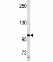 Progesterone Receptor antibody western blot analysis in SK-BR-3 lysate. Expected molecular weight: 82-94 kDa (isoform A) and 99-120 kDa (isoform B).