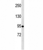 TLE1 Antibody / Notch Signaling Corepressor western blot analysis of human A549 cells. Lane 1: human A549 whole cell lysate. Proteins were separated by SDS-PAGE and transferred to a membrane for immunoblot detection using TLE1 Antibody / Notch Signaling Corepressor (clone 381CT18.5.1). A band is detected at approximately 83 kDa, consistent with the predicted molecular weight of Transducin-Like Enhancer Protein 1 (TLE1). The observed band represents endogenous expression of the Groucho family transcriptional corepressor involved in Notch signaling mediated transcriptional repression pathways.