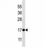 BAX antibody western blot analysis in MCF-7 lysate