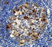 RPS6 antibody immunohistochemistry analysis in formalin fixed and paraffin embedded human tonsil tissue.