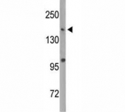 Western blot analysis of Dnmt1 antibody and MDA-MB435 lysate. Predicted molecular weight: 180-200 kDa