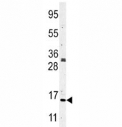 Western blot analysis of anti-Histone H3 in CEM lysate