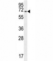 CD31 antibody western blot analysis in CHO lysate.