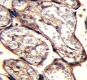 IGF2 antibody immunohistochemistry analysis in formalin fixed and paraffin embedded human placenta tissue.