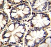 TNFR antibody immunohistochemistry analysis in formalin fixed and paraffin embedded human rectum tissue.